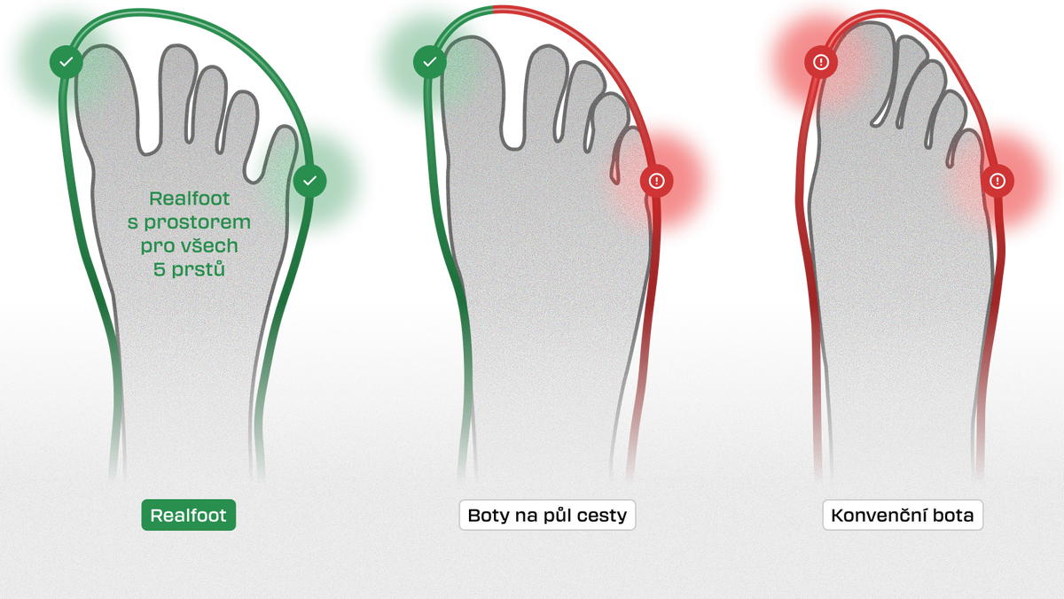 Toe box comparison: Realfoot, a halfway shoe and a conventional shoe